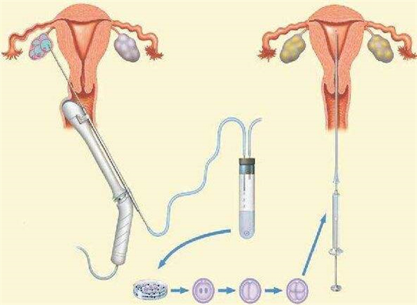 坐月子可以吃什么水果